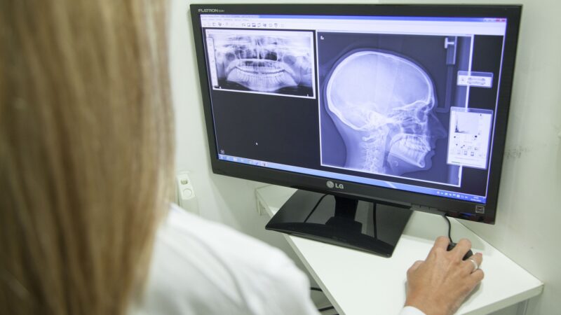 Nidzicki szpital będzie dysponował nowoczesnym centrum diagnostyki obrazowej